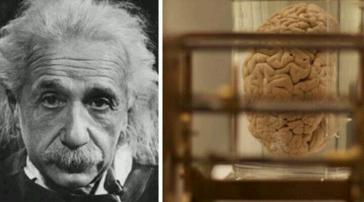 Top 10 Ways to Develop an Einstein Brain