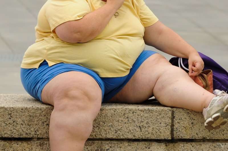Study Finds Selective Screening for Cushing’s Syndrome Effective in Metabolically Unhealthy Obesity
