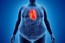 Is Cardiac Overload the Hidden Danger of Obesity