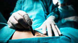 Is Gastric Bypass a Safe Cure or a Risky Bet for Obesity Treatment