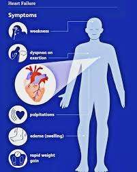 causes and risk of Cardiac Fluid Overload