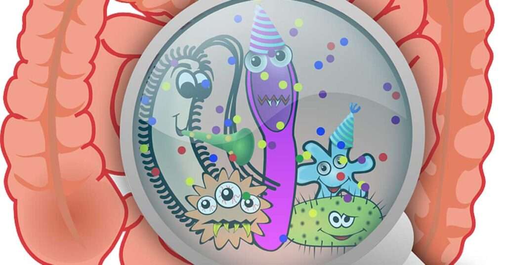 How Does Gut Dysbiosis Cause Obesity