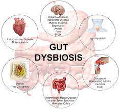 How Does Gut Dysbiosis Cause Obesity