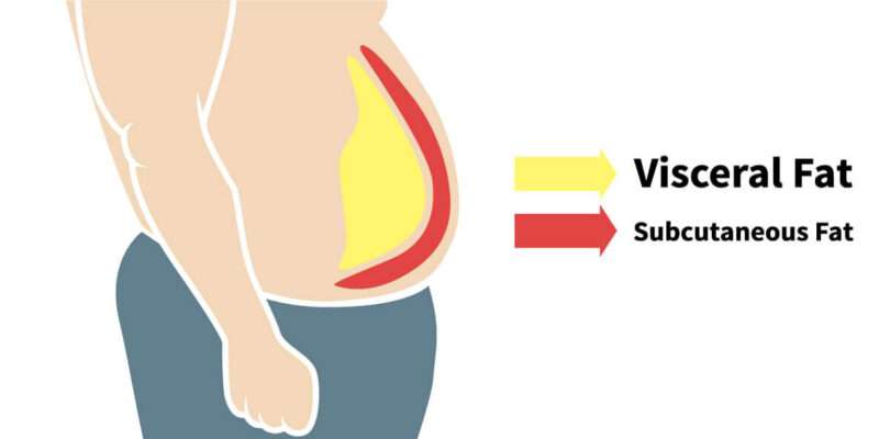 Role of Visceral Fat in Elevating Blood Pressure