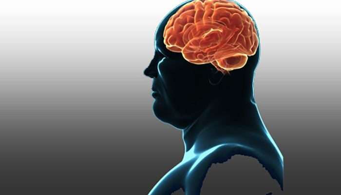 How Obesity Affects Brain Structure