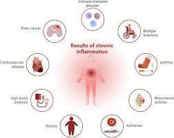 how and why you need to lose weight in order to treat dementia