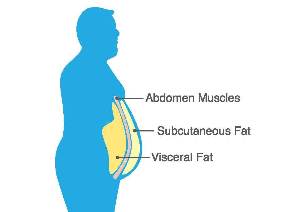 How lifestyle choices cause obesity