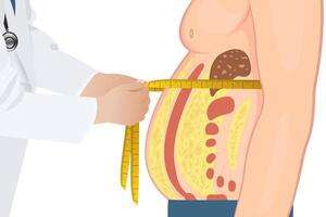 How Abdominal Obesity Increases the Risk of Metabolic Syndrome