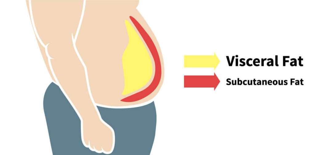 How Excess Body Fat Leads to High Blood Pressure
