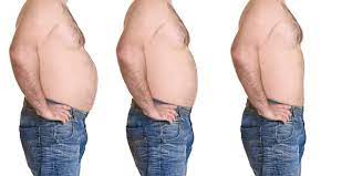 Kidney Compression due to Excess Fat