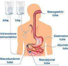 how body fat contributes to altered glucose metabolism