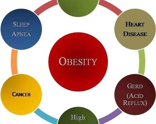 Why Obesity Rates are So High in Perry County, Arkansas
