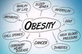how lifestyle and diet causes high obesity rates in Perry County, Arkansas