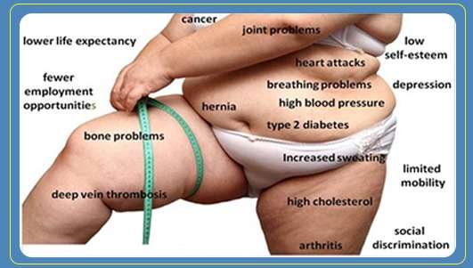 Causes of High Obesity Rates in Madison County, Mississippi